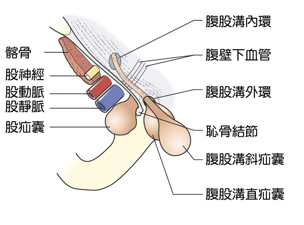 股疝氣和腹股溝疝氣周遭解剖圖